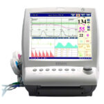 Monitor Fetal Gemelar